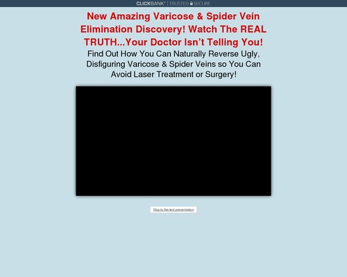 Varicose Veins Natural Treatment | Varicose Veins Home Treatment Program